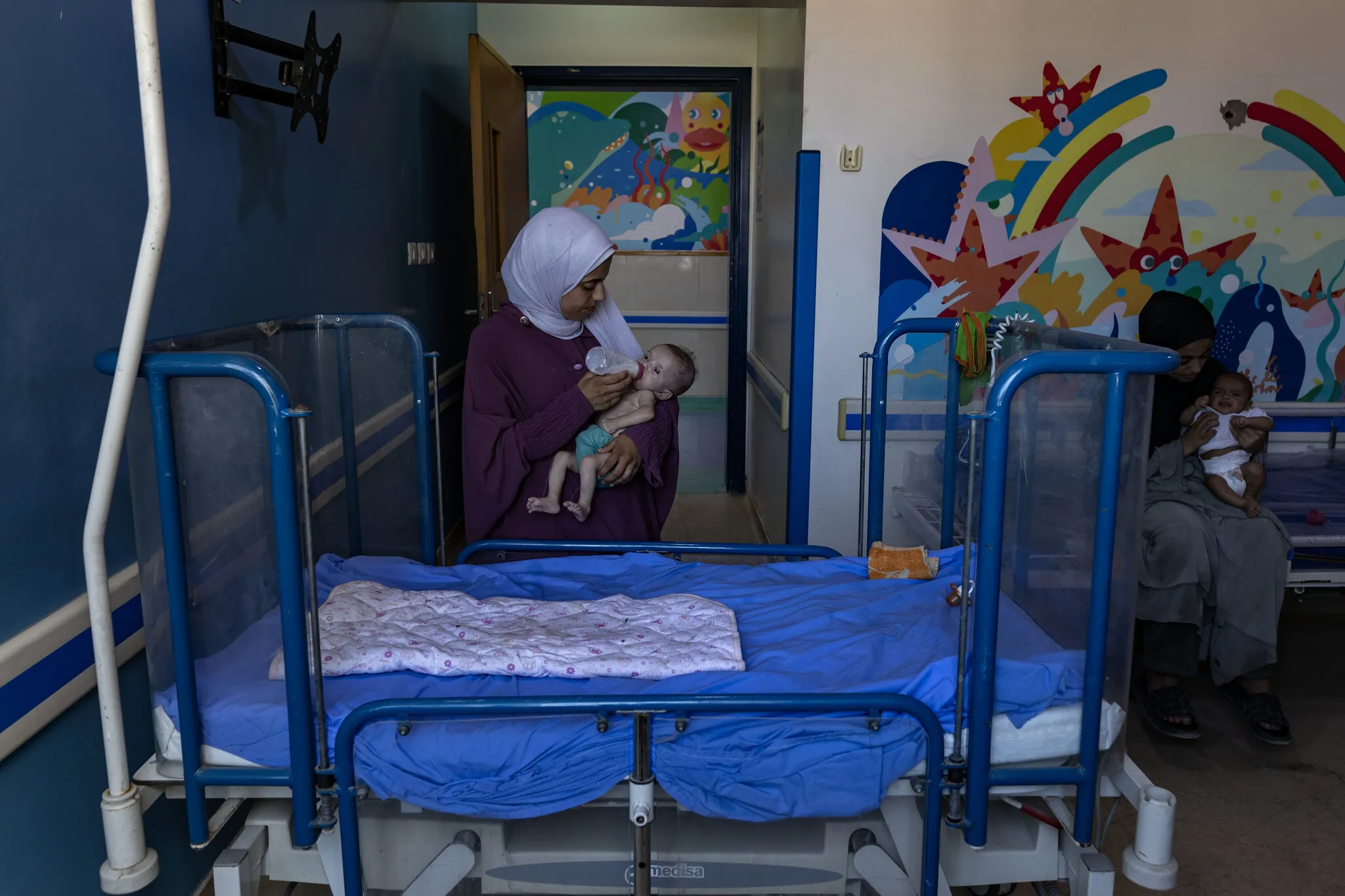 Малюки під загрозою: як недоїдання руйнує дитячі тіла в Газі